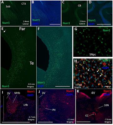 Quantitative Immunohistochemistry to Measure Regional Expression of Nurr1 in the Brain and the Effect of the Nurr1 Heterozygous Genotype